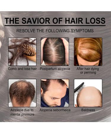 Buy Rosemary Oil for Hair Growth - 30ml Essential Oil | Natural Hair & Skin Care | Nourishes Scalp Eyebrows & Eyelashes (3PCs) - Buy Online on GoSupps.com