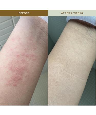 EADEM Mami-Wata Ultra Calming Rescue Mist Face Mist Hydrating Spray Hydrating Facial Spray Barrier Repair Serum Skin Barrier Serum Makeup Refresher 100 ml - Buy Online on GoSupps.com