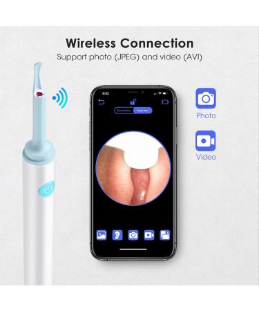 Earify Ear Wax Removal Kit with Camera and Light - Ear Wax Cleaner for Adults & Kids (White) - Buy Online on GoSupps.com