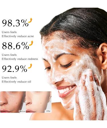 Jasmine Rice Face Wash Gentle Acne Face Wash Pure Rice Cleansing Foam Refreshing Face Wash Pore Deep Cleansing Foam Daily Gentle Cleanser Hydrating Cleanser for Radiant Smooth Exfoliating - Buy Online on GoSupps.com
