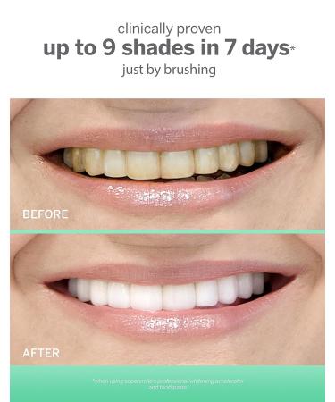 Supersmile Extra White Large & Small System | 2 Toothbrushes for Ultimate Whiteness | International Shipping - Buy Online on GoSupps.com