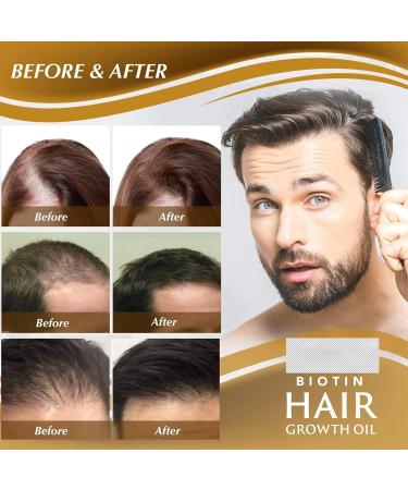 Hair Growth Spray - Hair Growth Serum with Biotin - Hair Serum for Hair Growth - Hair Loss Treatment For Men Women - Biotin Thickening Herbal Serum - Biotin Premium Herbal Serum - 20ml - Buy Online on GoSupps.com