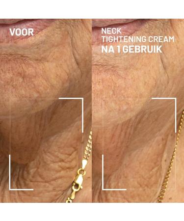 Dr Brandt Skincare Dr Brandt Needles No More Neck Tightening Cream Lifts firms and reduces sagging skin Includes a rose quartz Gua Sha tool 50 g - Buy Online on GoSupps.com