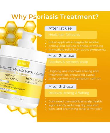 Antifungal Psoriasis Deep Conditioner Treatment for Eczema & Seborrheic Dermatitis | Soothes Itching Repairs Scalp Strengthens Hair & Stimulates Regrowth | Shop Internationally - Buy Online on GoSupps.com