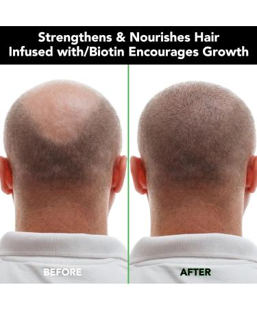 Buy Tiuedu Jamaican Black Castor Oil Shampoo for Thinning Hair - Best Hair Care for Men & Women | Promote Hair Growth - Buy Online on GoSupps.com