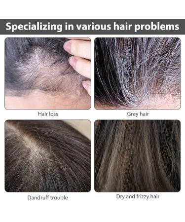 Darka Anti-Graying Hair Serum | 3pcs Ganoderma Nutrient Formula for Hair Growth & Eyebrow Care | Natural Anti-Gray Solution - Buy Online on GoSupps.com