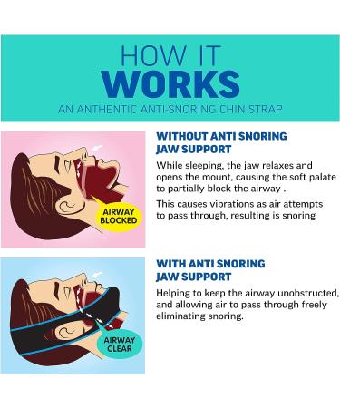 BONNA Anti Snoring Chin Strap & Nose Vents - Stop Snoring Solution for Men and Women - Buy Online on GoSupps.com