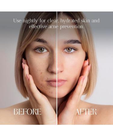 Acne Night Cream | Water-Based Moisturizer for Acne-Prone Skin | 1% Salicylic Acid & Soothing Tea Tree Oil - Shop Internationally - Buy Online on GoSupps.com