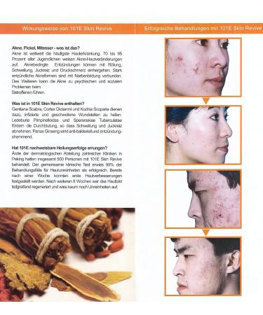 Fabao 101E Skin Revive - Acne Treatment Lotion for Flawless Skin | Shop Internationally - Buy Online on GoSupps.com