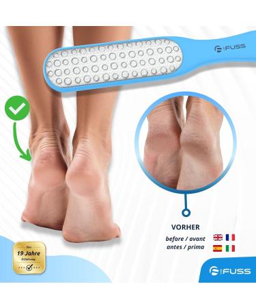 Mr. Fuss Laser Hornhaut Trash - Double-Sided Corneal File for Safe & Effective Corn Removal - Non-Slip Plastic & Stainless Steel in Blue - Buy Online on GoSupps.com