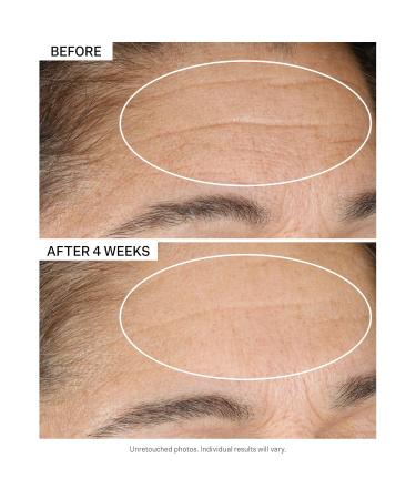 StriVectin Advanced Retinol Discovery Kit | Retinol Night Moisturizer & Multi-Correct Eye Cream for Wrinkles & Fine Lines - 2 Piece Set - Buy Online on GoSupps.com