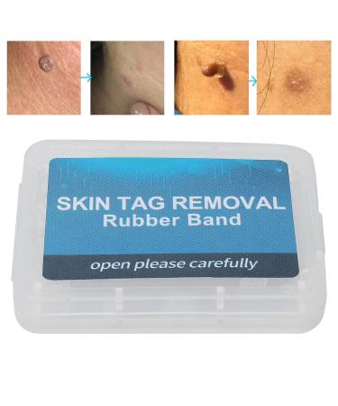 30 Pieces Skin Day Distant Rubber Bands | Fast & Safe Wart Removal | Non-Toxic Skin Care Tools - Buy Online on GoSupps.com