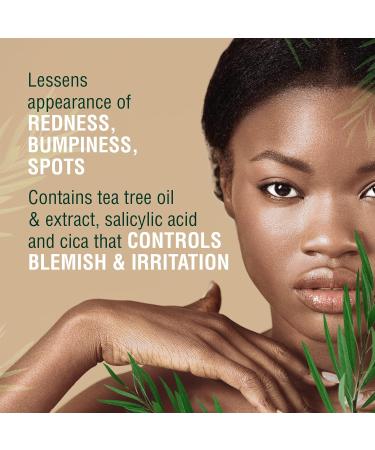 KISS New York Tea Tree Spot Cream - Lightweight Korean Skincare for Blemishes | International Shipping - Buy Online on GoSupps.com