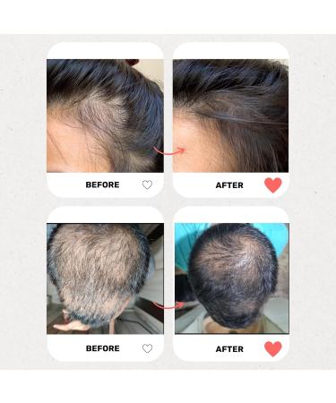 Hair Revitalizer - Ayurvedic Hair Growth Remedy | Fall Protection Nourishment & Moisturization | 10 Potent Oils | All Hair Types - 1 Fl. Oz - Buy Online on GoSupps.com