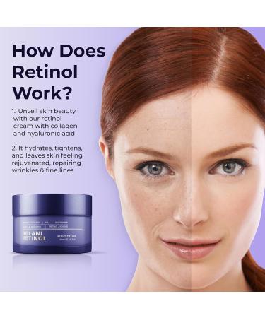 ABERA Belani Retinol Cream - Dark Spot Remover & Anti-Aging Night Cream for Women | Treat Melasma Fine Lines & Wrinkles (1.01 Fl Oz - Buy Online on GoSupps.com