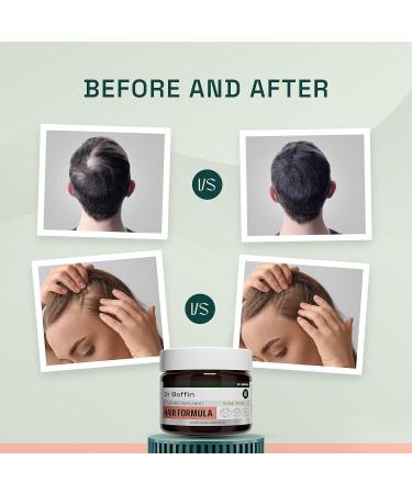 23-in-1 Hair Growth Formula for Men & Women - Biotin 6000 mcg - Advanced Herbal Supplement for Faster Hair Thickness - 90-Day Supply - Buy Online on GoSupps.com