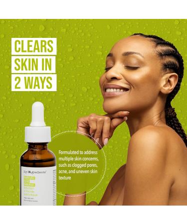 Masque Bar My Ingredients Salicylic Acid Solution - Exfoliating Solution For Face - Healing Acne Spot Treatment For Blemish Prone Skin Korean Skincare - 1Fl oz Salicylic Acid Serum - Buy Online on GoSupps.com