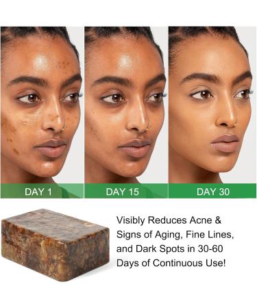  WeiWeiLa Organic African black soap 200g African soap against acne and dark spots raw black soap for all skin types face body hair - Buy Online on GoSupps.com