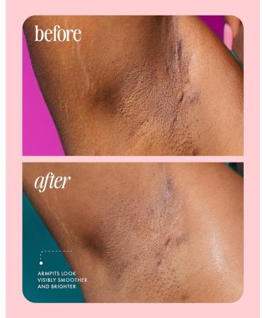 Truly Beauty Unicorn Fruit Aluminum Free Deodorant for Women with Cotton Candy Scent - Natural Deodorant for Brighter and Smoother Underarms - 3 Oz - Buy Online on GoSupps.com