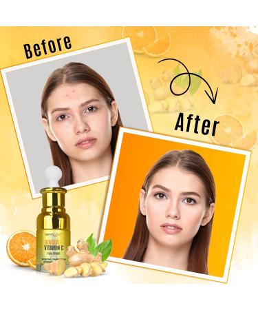 Ginger Face Serum with Vitamin C & Turmeric | Organic Acne Treatment for Clear Skin Hydration & Anti-Aging | 1 FL OZ - Buy Online on GoSupps.com