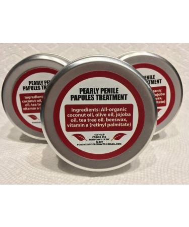 Pearly Penile Papules Removal Cream - Fordyce Spots treatment for Pearly Penile Papules