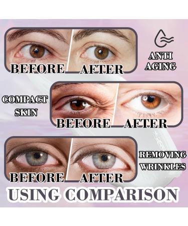 Retinol Eye Cream for Men & Women - Daily Hydrating Moisturizer for Dark Circles & Puffiness - Buy Online on GoSupps.com