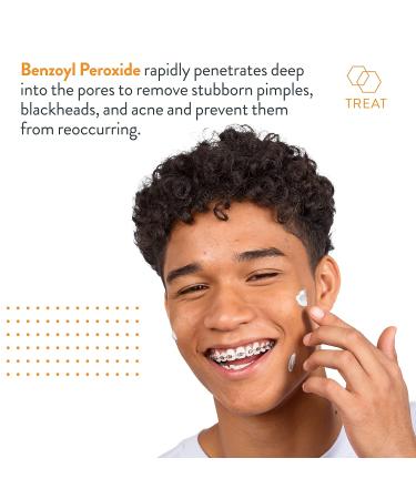 Acne Free Terminator 10 - Benzoyl Peroxide 10% Acne Spot Treatment (Pack of 3) - Buy Online on GoSupps.com