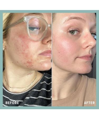 BOHO Skin Cleansing Balm - Hydrating Makeup Remover & Facial Cleanser for All Skin Types | Natural Deep Pore Cleanser with Vitamin E & Botanical Extracts (2oz - Buy Online on GoSupps.com