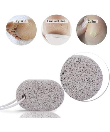 PHOGARY Natural Pumice Stone for Feet 3 PCS - Lava Pedicure Tools for Callus Removal on Feet and Hands - Exfoliating Foot File for Dead Skin Removal - Buy Online on GoSupps.com
