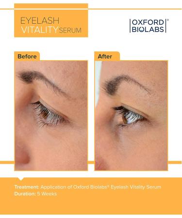 Buy Eyelash Vitality Growth Serum - Enhance Lash Growth Naturally Irritation-Free & Hypoallergenic | 3.5 ml - Buy Online on GoSupps.com