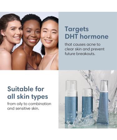 Hormonal Acne Solution | Natural Anti-DHT Benzoyl Peroxide Formula | 1 Month Original Benzoyl Kit - International Shipping - Buy Online on GoSupps.com