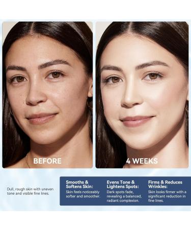 Instant Face Lift Cream with Retinol, Collagen & Hyaluronic Acid, Neck Cream for Tightening and Firming - Anti Aging Face Moisturizer for Women & Men Reduce Wrinkle, Retinol Cream for Face, 1.7 FL OZ 1.7 Fl Oz (Pack of 1) - Buy Online on GoSupps.com