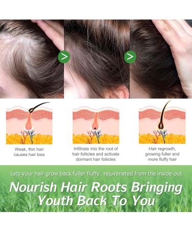 ELBBUB Rosemary Oil for Hair Growth - Undiluted Rosemary Oil for Hair Skin - Cleansing Rosemary Essential Oil for Dry Scalp Care Rid of Itchy and Dry Scalp 1 120.0 millilitre - Buy Online on GoSupps.com