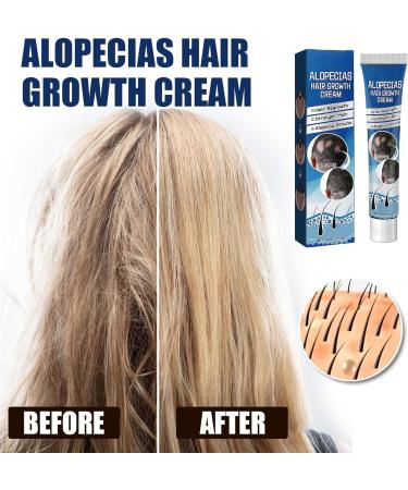 Kanoauo Hair Growth Cream 20 g regrowth cream strengthens the roots promotes scalp health and restores hair growth accelerates hair growth - Buy Online on GoSupps.com
