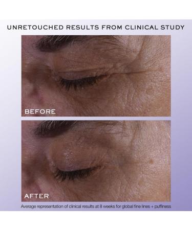 Lanc me R nergie H.C.F. Triple Eye Serum - Anti-Aging Lift & Reduce Eye Wrinkles with Hyaluronic Acid Vitamin C & Niacinamide - 0.67 Fl Oz | International Shipping Available - Buy Online on GoSupps.com