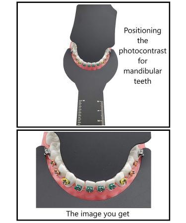 ARTMAN Photographic Black Contraster 6pcs Cassette Autoclavable Cheek Retractors - Dental Orthodontic Oral Photography Backdrop - Buy Online on GoSupps.com