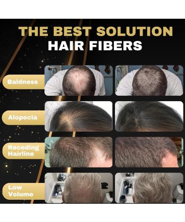 Salvathor Duran Hair Fibres Hair Fibres Hair powder Fibres Thick Fiber Hair Fibre Hair Fiber Hair Fibers Thick Fibre 25g Bottle Completely Conceals Hair Loss (Medium Brown) - Buy Online on GoSupps.com