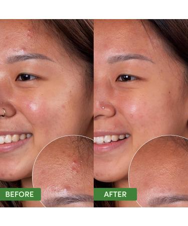 Sand & Sky Oil Control Clearing Cleanser | Gentle Daily Face Wash for Oily Acne-Prone & Sensitive Skin with Salicylic Acid AHAs & Prebiotics | International Shipping Available - Buy Online on GoSupps.com