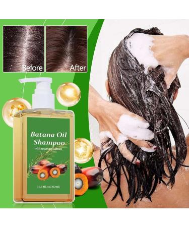 Batan Oil Rosemary Lot de 2 shampoings nourrissants r g n rants r duisent la chute des cheveux conviennent aux hommes et aux femmes favorisent la croissance les cheveux doux et volumineux - Buy Online on GoSupps.com
