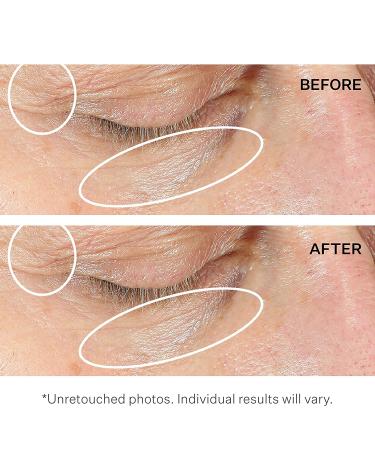 StriVectin Anti-Wrinkle Intensive Eye Cream Concentrate - Targets Crow's Feet, Firmness & Dark Circles - 0.25 Fl Oz - Buy Online on GoSupps.com