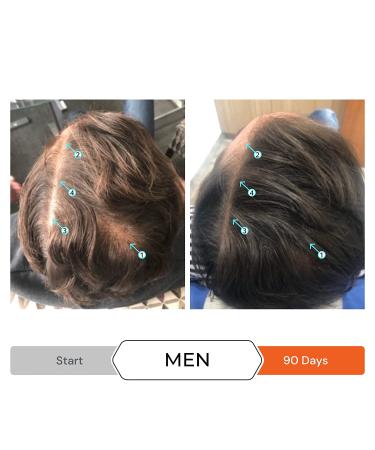 Revita Volumizing Conditioner for Thinning Hair - Hair Growth Support for Men and Women - Hair Thickening and Strengthening - Sulfate Free - 31 fl oz - Buy Online on GoSupps.com