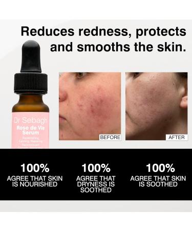 Dr Sebagh Rose de Vie Serum - 0.17 fl oz - Award-Winning Nourishing Anti-Aging Formula - Use with Dry Mature or Sensitive Skin - Designed to Soothe Redness & Irritation - Regenerating & Invigorating - Buy Online on GoSupps.com