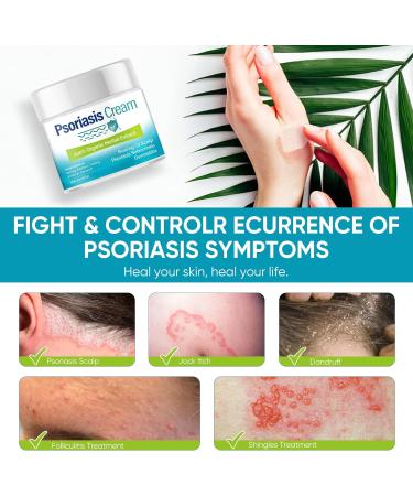 iTecFreely Psoriasis Cream: Fast & Effective Scalp Treatment for Dry Scalp, Dandruff & Eczema - Face and Body Relief - Buy Online on GoSupps.com