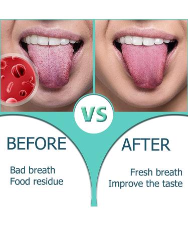 Stainless Steel Tongue Scraper - 2 Pack, BPA Free, Medical Grade Cleaner for Adults & Kids - Fight Bad Breath & Improve Oral Hygiene - Buy Online on GoSupps.com