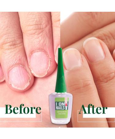 I On Nails: Ultimate Nail Strengthener & Growth Treatment - Clear Hardener & Keratin Repair for Damaged Nails - Buy Online on GoSupps.com