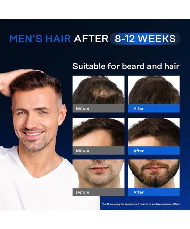 Intensive Hair Regrowth Treatment - 5% Active Complex | Natural Organic Formula for All Hair Types | 2 Fl OZ | Stop Hair Loss for Women & Men - Buy Online on GoSupps.com