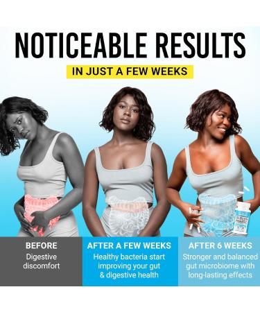 BIGJOHNLAB Probiotics 60 Billion CFU 10 Strains + Organic Prebiotics Immune, Digestive & Gut Health Supports Occasional Constipation, Diarrhea, Gas & Bloating for Women & Men 30ct Advanced Formula 30 Count (Pack  - Buy Online on GoSupps.com