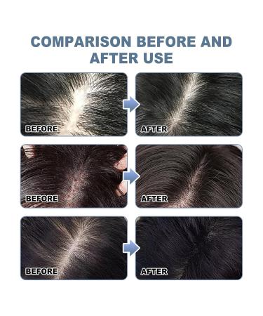 100g Nourishing Hair Scrub for Scalp Exfoliation Deep Cleansing Scalp Scrub to Unclog Follicles Remove Buildup & Promote Healthier Hair Growth - Buy Online on GoSupps.com