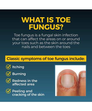 Fungi-Nail Anti-Fungal Liquid Solution - Clinically Proven to Cure Nail & Athlete's Foot Fungus with Tolnaftate - Buy Online on GoSupps.com