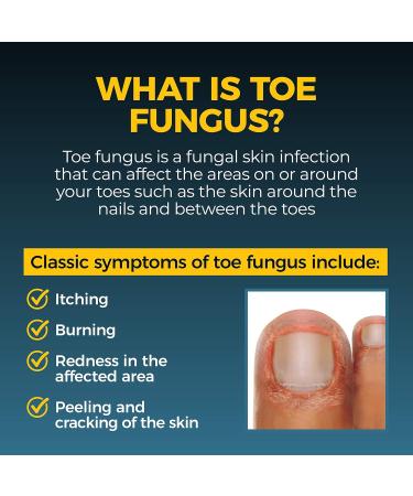 Maximum Strength Fungi Nail Anti Fungal Treatment 1.7mL - Toe and Foot Care - Buy Online on GoSupps.com